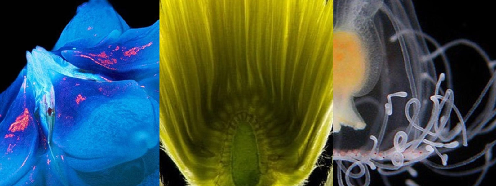 【顕微鏡による拡大写真有り】MTG ドイツ語 Tropical  Amazon.co.jp: デジタル顕微鏡 USB電子顕微鏡 7インチLCD