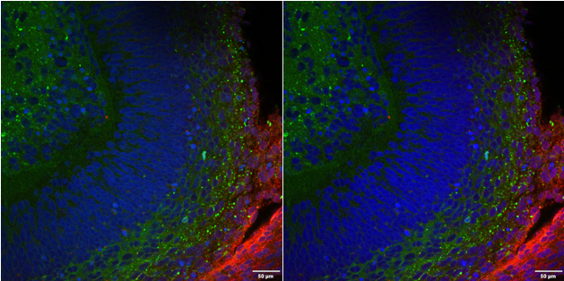 対物レンズを動かした後もシリコーンゲルが接触を維持する様子を示す比較画像。
