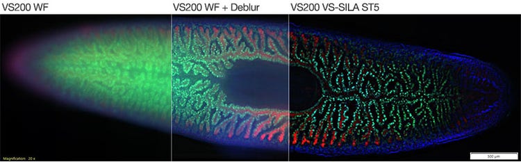 プラナリアをソフトウェアでデコンボリューション処理した従来の広視野画像とVS-SILA画像