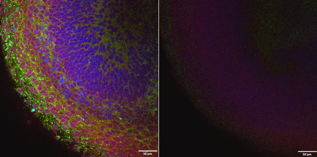 シリコーンオイル浸対物レンズのオイル切れが、画像の明るさや画質低下を招く様子を示す比較画像。