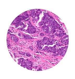 ケーラー照明の調整プロセスで試料に焦点を合わせたときの画像