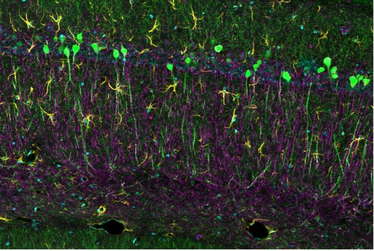 顕微鏡で観察したH-lineマウス脳