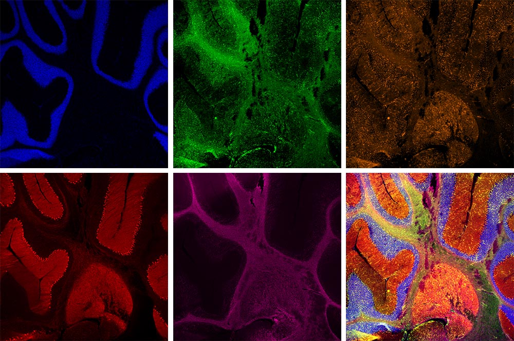 発色 サンプル画像 イメージギャラリー | APEXVIEW | オリンパス ライフサイエンス