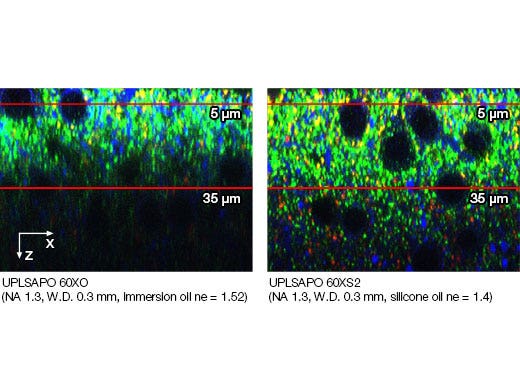 Image data courtesy of Motokazu Uchigashima, M.D., Ph.D., Masahiko Watanabe, M.D., Ph.D., Departments of Anatomy, Hokkaido University Graduate School of Medicine