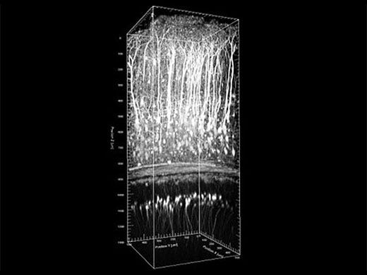 Image data courtesy of Katsuya Ozawa and Hajime Hirase, Neuron–Glia Circuitry, RIKEN Brain Science Institute, Japan