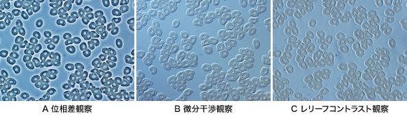図1 観察法の違いによる比較画像