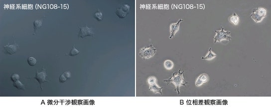 図1 微分干渉観察と位相差観察の比較