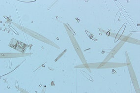 図3 珪藻（対物10×）