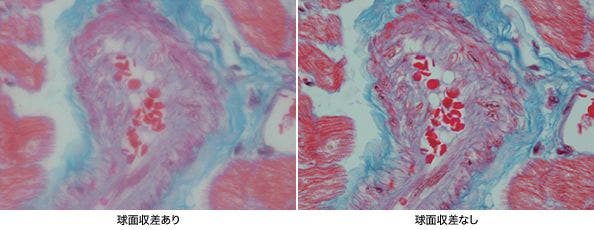 図12 球面収差の例