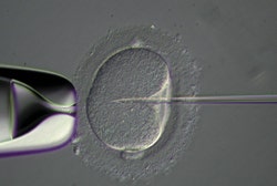 図18 レリーフコントラスト観察による人工授精