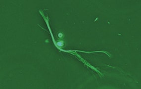 図14 ネガティブコントラスト（アスベスト）