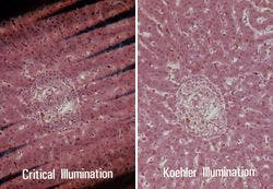 図2 クリティカル照明とケーラー照明の比較