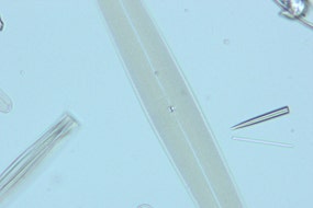 図4 珪藻（対物40×）