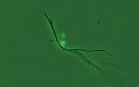 図13 ポジティブコントラスト（アスベスト）