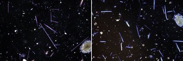 図19 分散観察によるアモサイトの検出