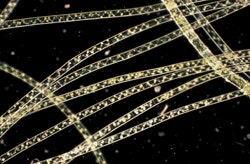 図11 暗視野観察による無染色の藻（アオミドロ）