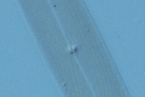 図7 コントラストが低い