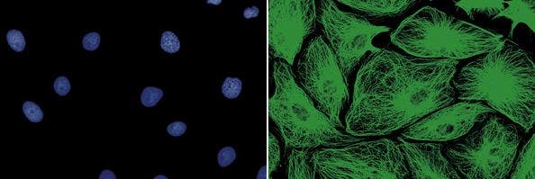 図17 蛍光観察による細胞核と細胞骨格の検出