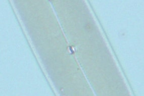 図5 分解能が不十分