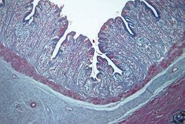 図15 像面湾曲収差の例