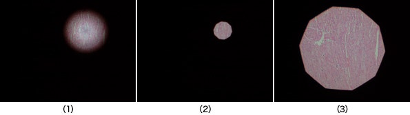 図2 視野絞りの調整方法