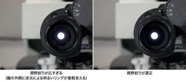 図3 瞳の外側に見える光のリング