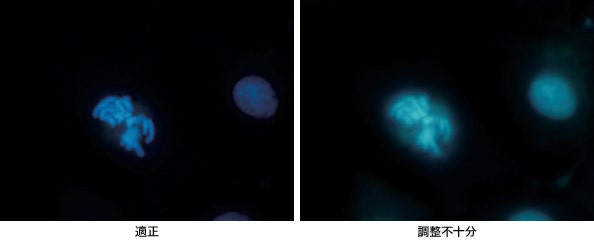 図11 絞り付き対物レンズによる調整の影響