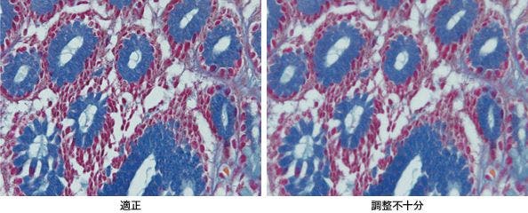 図10 補正環付き対物レンズによる調整の影響