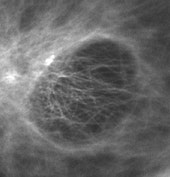 図5 水浸対物レンズ NA 1.2