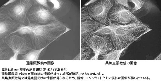 図3 通常顕微鏡と蛍光共焦点顕微鏡の画像比較