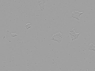 図3 同視野の経時変化の画像