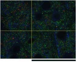 UPLASAPO60XO, Z=35μm