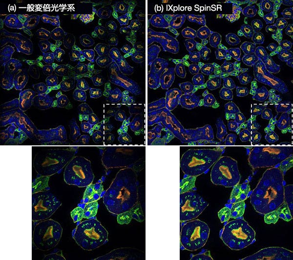 図９．IXplore SpinSR専用の変倍光学系で接続したシステム(b)と一般的な変倍光学系で接続したシステム(a)で取得した蛍光画像16枚（縦4枚x横4枚）を貼り合わせた画像。