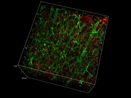 3D mouse brain tissue