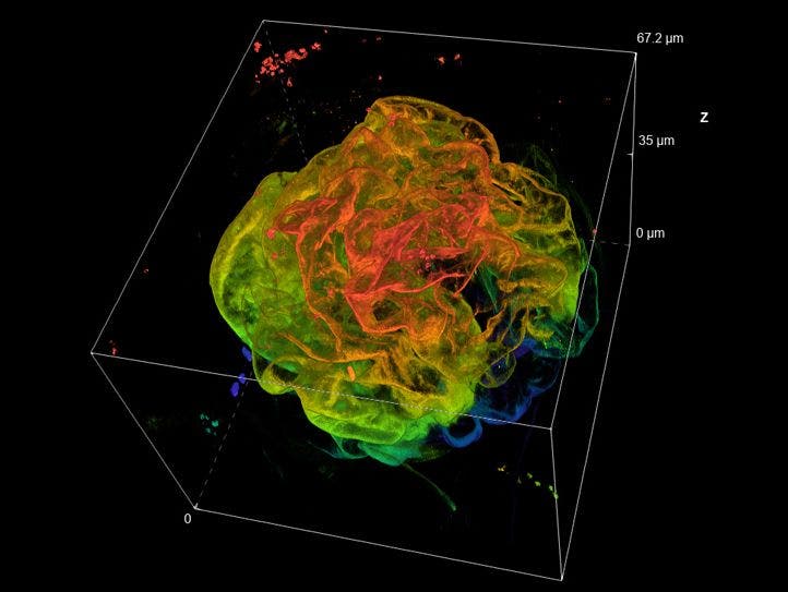 3D glomerulus