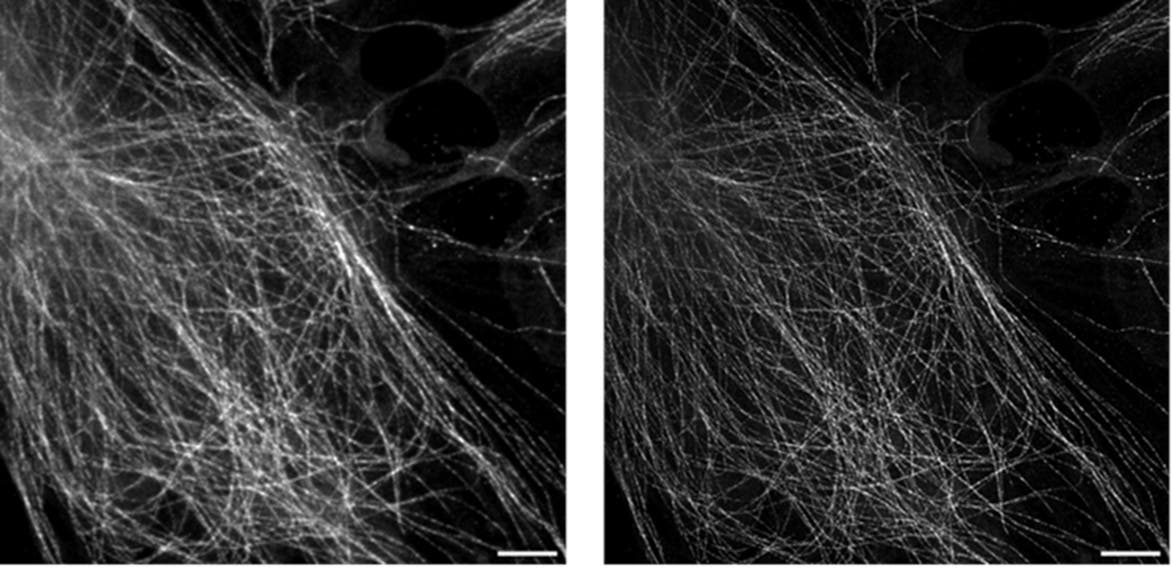 超解像顕微鏡 | Evident