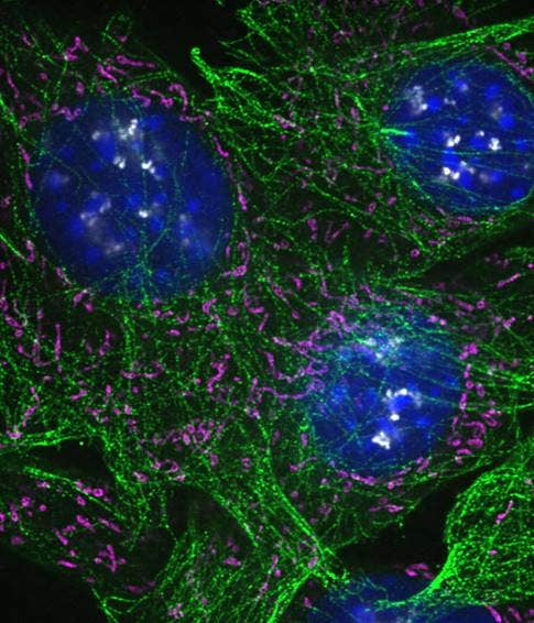 NIH3T3 cells labeled with Hoechst (blue), β-tubulin–AF555 (green), CPCA–HSP60–AF647 (magenta), and fibrillarin–AF568 (gray). Scale bar: 5 µm. Sample courtesy of EnCor Biotechnology Inc.