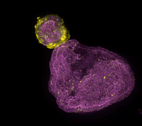Organoid. Phalloidin (magenta), E-cadherin (yellow).