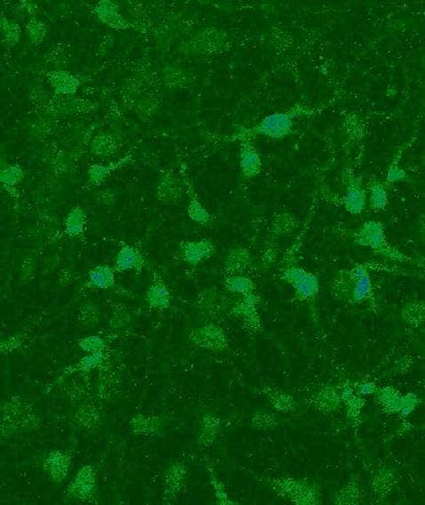 Calcium imaging: chemical indicator Fluo-3 in neuronal cells.