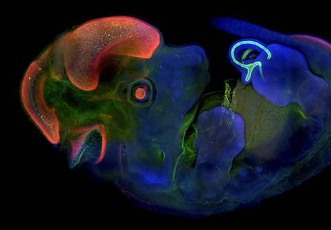 Mouse embryo. SOX1 (Cy3), CDX2 (green), DAPI (blue). Courtesy of Dr. Yingying Chen, Naihe Jing’s Lab.