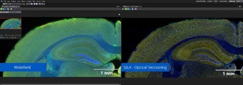 スライド標本の高速スキャンとセクショニング撮影を1台で実現し、研究データ作成の作業効率改善に貢献