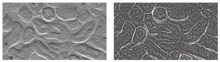 マウスの腎臓組織の観察比較（左：グラディエントコントラスト観察、右：位相差観察）