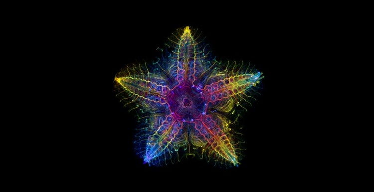 グローバル最優秀　「ヒトデの幼生」　Laurent・Formery（米国）