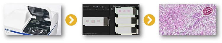 APX100での観察開始までの流れ