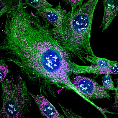 IXplore IX85 Spin 倒立顕微鏡システム | Evident Scientific | Olympus