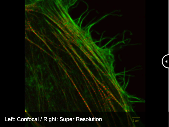pirop　訳あり数点写真 IXplore IX83 SpinSR 超解像顕微鏡システム | Evident Scientific