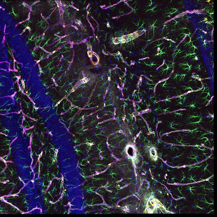 マウス海馬のneurovascular unit