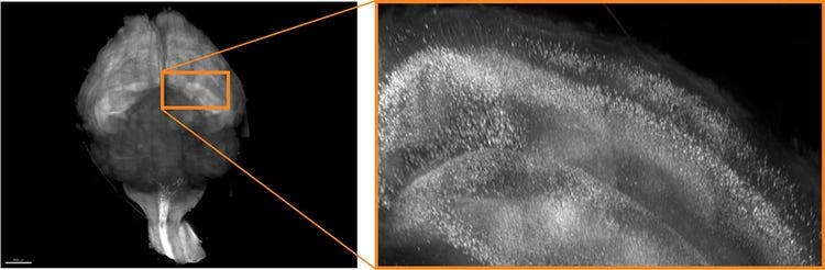 レゾナントスキャナーで撮影された透明化された脳全体の10倍貼り合わせ画像