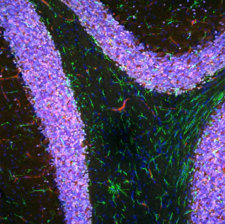 ズームインしてTruSightデコンボリューションを適用した画像