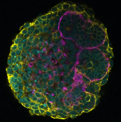 Human iPSC-derived kidney organoids with membrane-GFP.